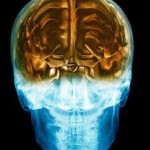 Электрические импульсы в мозг помогут человеку поумнеть