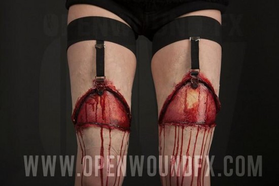 Gartered Leg Prosthetics