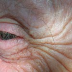 Ученые успешно реверсируют старение у мышей