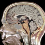 Ученые «помечают»  мозговые молекулы и наблюдают, как они становятся воспоминаниями