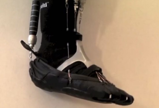 robot-ankle